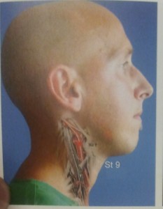 photo3
